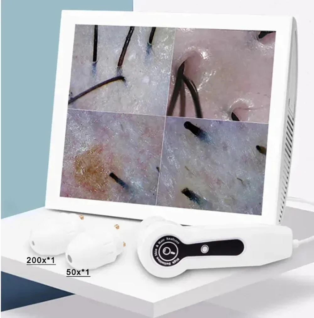15-инчов LCD детектор на анализатора на кожата и косата, Дигитален микроскоп, Лупа, Кожа, Фоликули от черни точки, Детектор на кожата на главата 50X-200X